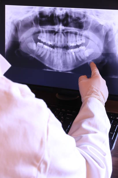 Best Emergency Dental Extractions in Prospect Rk, PA
