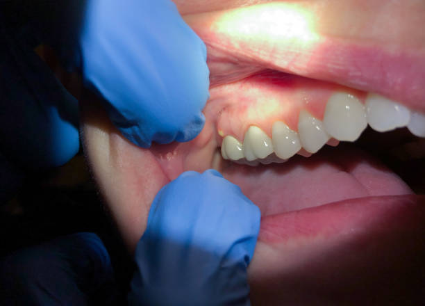 Best Pediatric Emergency Dentist in Prospect Rk, PA