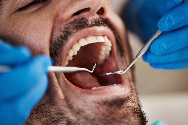 Best Emergency Dentist for Lost Fillings or Crowns in Prospect Rk, PA